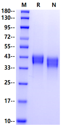 Carbonic Anhydrase XII His Tag Protein, Mouse