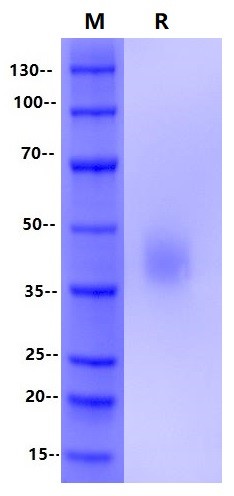 B7-H3/CD276 His Tag Protein, Human