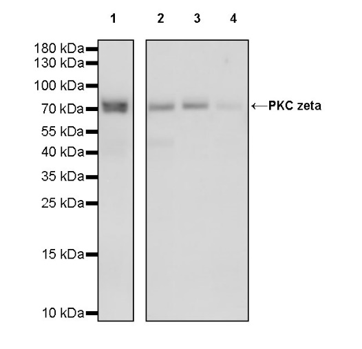 PKC zeta Recombinant Rabbit mAb (S-1306-34)