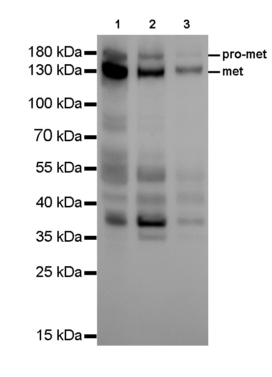 c-Met Recombinant Rabbit mAb (SDT-009-7)
