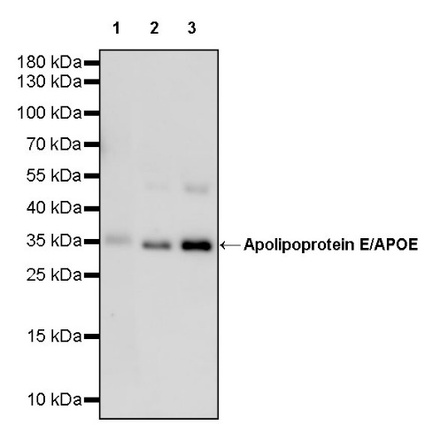 Apolipoprotein E/APOE Recombinant Rabbit mAb (S-970-75)