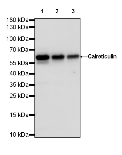 Calreticulin Recombinant Rabbit mAb (S-R353)