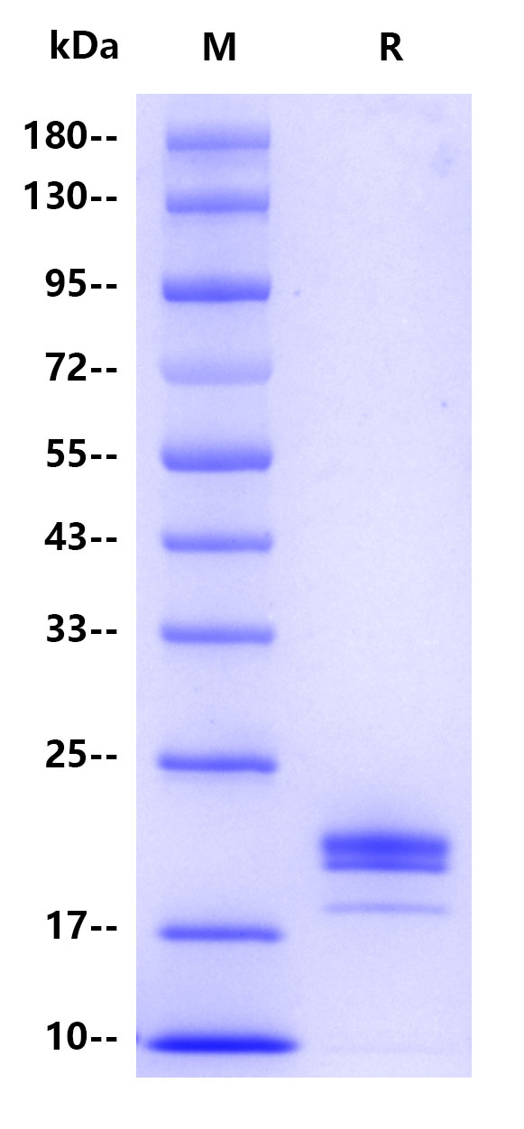 Human IL-1beta, His tag