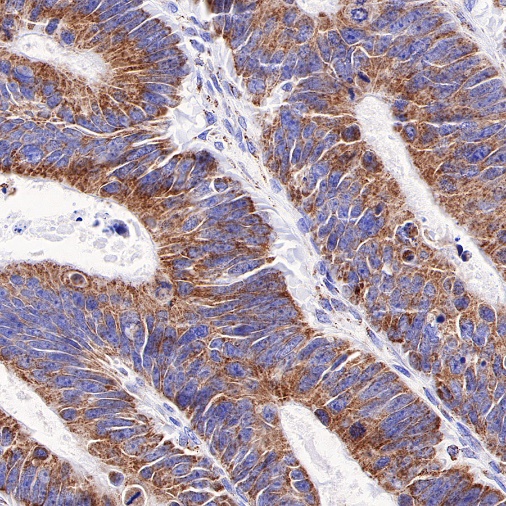PTP1B Recombinant Rabbit mAb (S-R336)