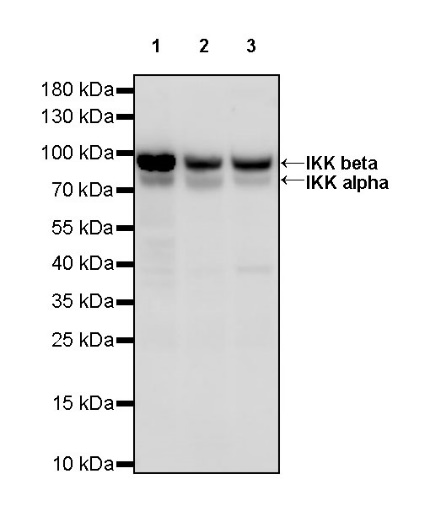 IKK alpha/beta Recombinant Rabbit mAb (S-1317-27)