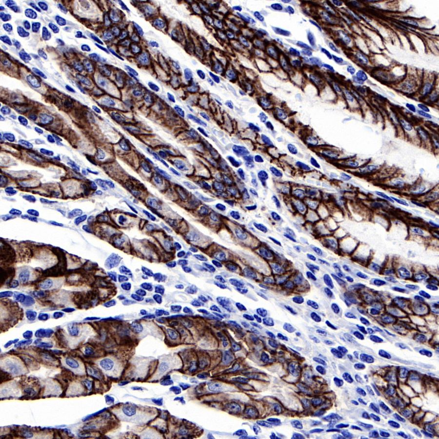 S-RMab® Claudin18.2 Recombinant Rabbit mAb (SDT-102-83)