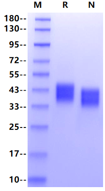 CD84/SLAMF5 His Tag Protein, Human