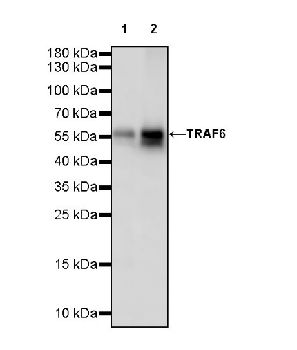TRAF6 Recombinant Rabbit mAb (S-1087-44)