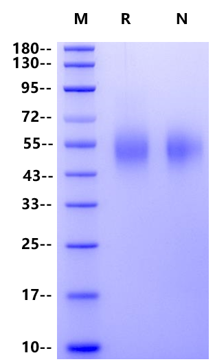 CEACAM-6/CD66c His Tag Protein, Human