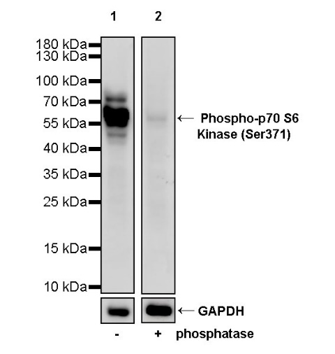 Phospho-p70 S6 Kinase (Ser371) Recombinant Rabbit mAb (S-1239-6)