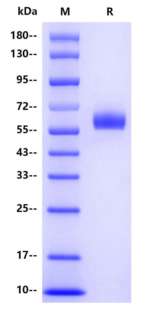 Human Antithrombin-III, His tag