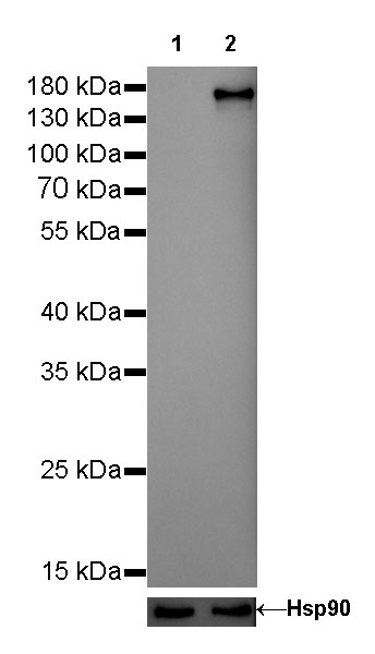 S-RMab® ErbB2 Recombinant Rabbit mAb (SDT-069-57)