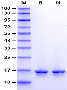 FABP9 His Tag Protein, Human