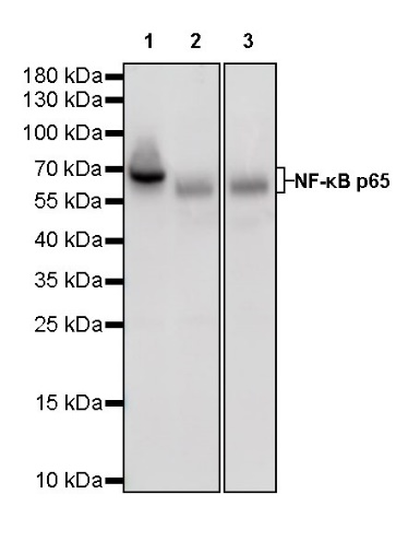 NF-κB p65 Recombinant Rabbit mAb (S-475-56)