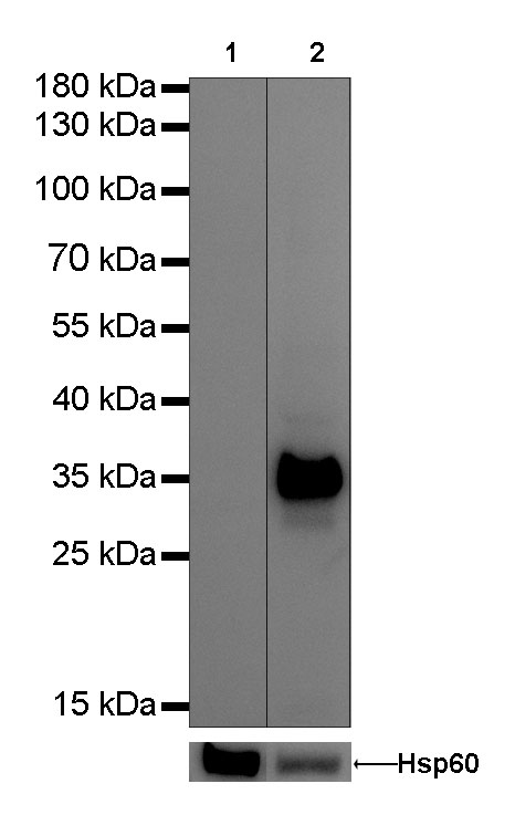 Calponin-1 Recombinant Rabbit mAb(SDT-080-78)