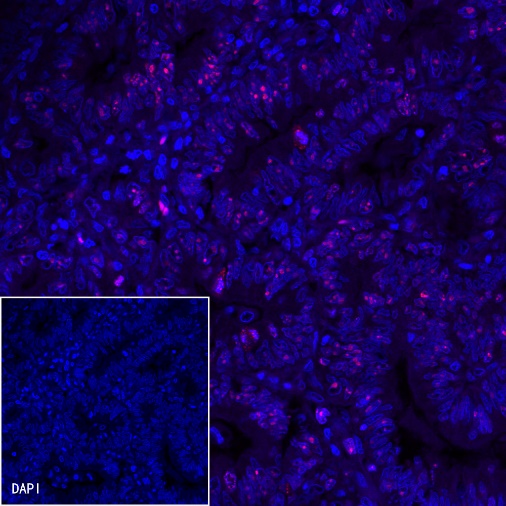 Ki67 Recombinant Mouse mAb (Alexa Fluor® 594 Conjugate) (S-606-7)