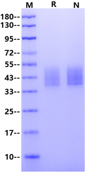 IL-4R alpha/CD124 His Tag Protein, Human