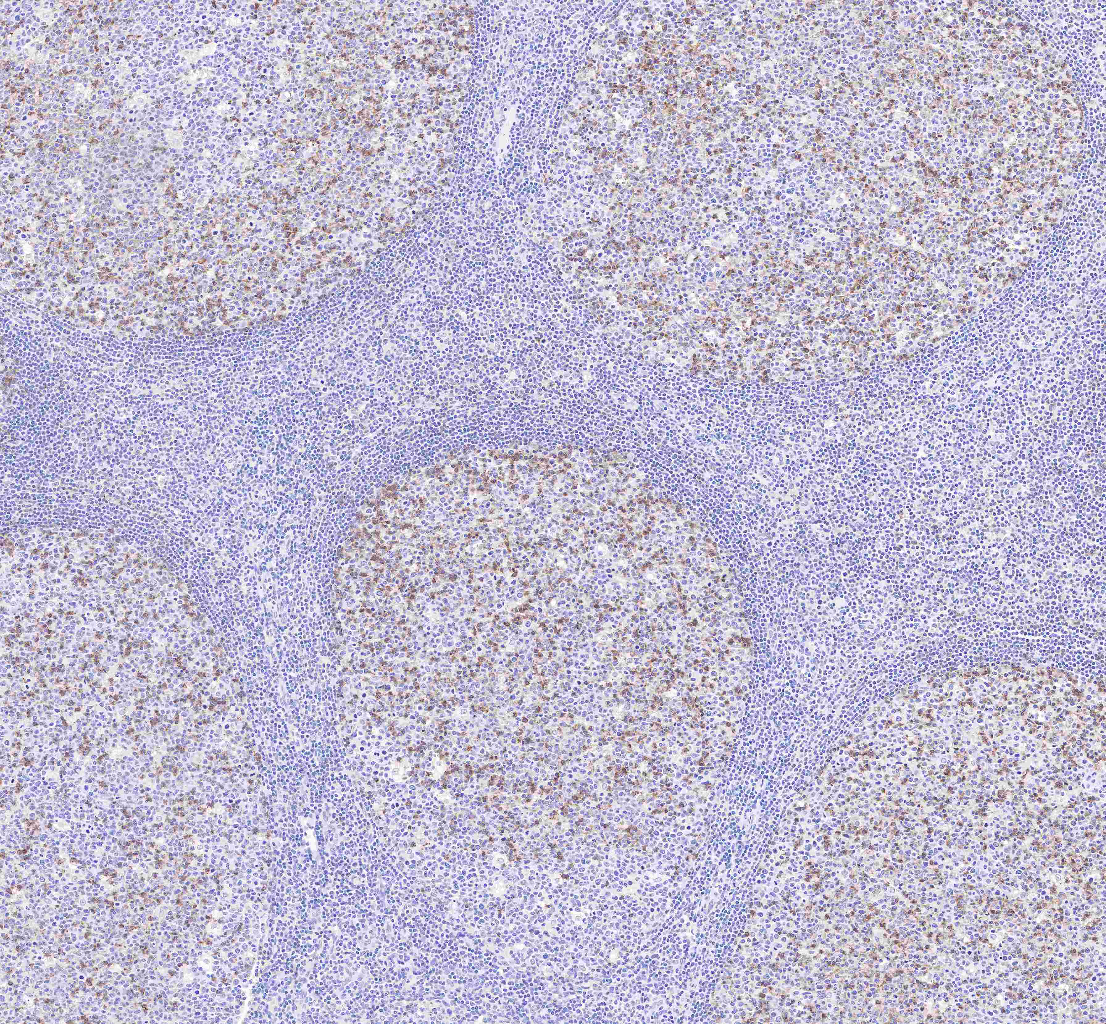 PD-1 Recombinant Rabbit mAb (SDT-035-25)