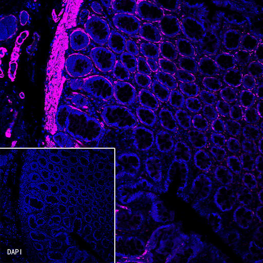 alpha smooth muscle Actin Recombinant Rabbit mAb (Cy5 Conjugate) (SDT-132-63)