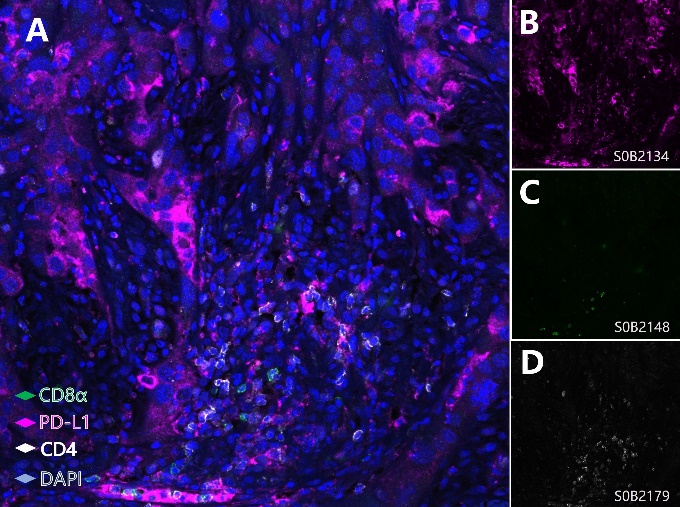 PD-L1, Cytotoxic T cell and Helper T cell (PD-L1, CD8α, CD4) Antibody Panel