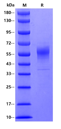 Human PLA2G7, His tag