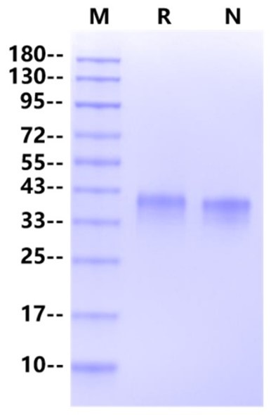 FOLR1 His Tag Protein, Human