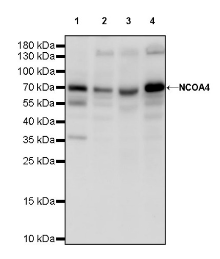 NCOA4 Recombinant Rabbit mAb (S-1211-40)