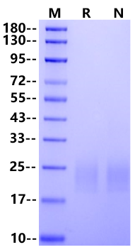 CTLA-4/CD152 His Tag Protein, Rat