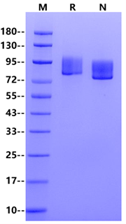 MUC18/CD146 His Tag Protein, Mouse
