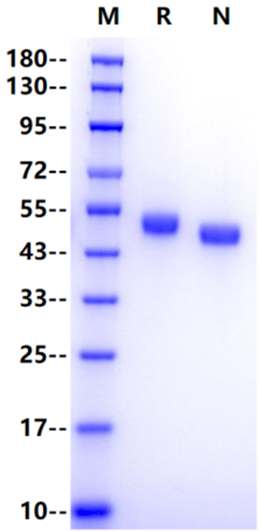 AGER His Tag Protein, Human
