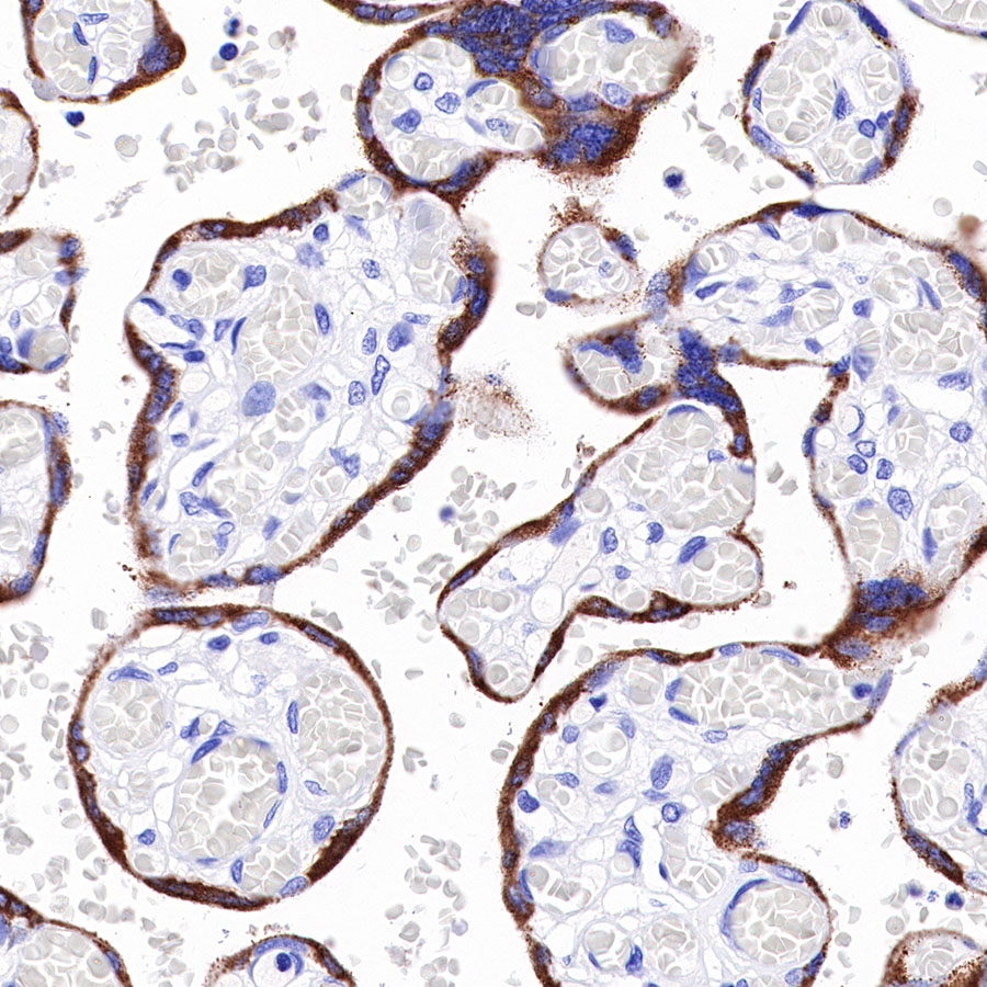 CGA/HCG-α Recombinant Rabbit mAb (SDT-227-66)