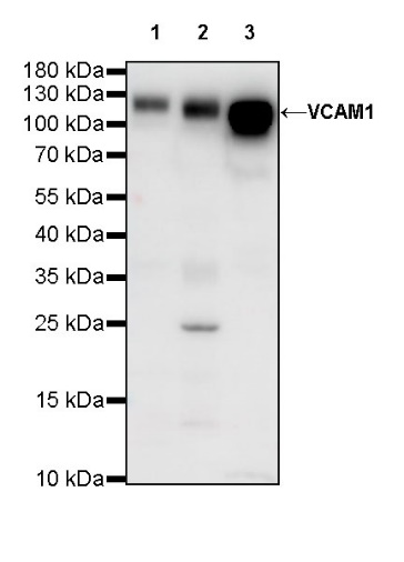 VCAM1 Recombinant Rabbit mAb (S-650-19)