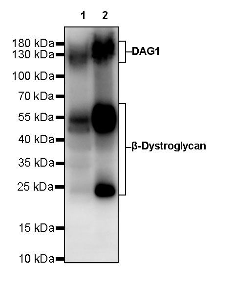 DAG1 Recombinant Mouse mAb (S-R191)