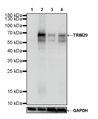 TRIM29 Recombinant Rabbit mAb (S-642-43)