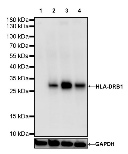 HLA-DRB1 Recombinant Rabbit mAb (SDT-R253)