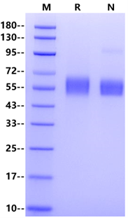 IL-1RAcP/IL-1R3 His Tag Protein, Mouse