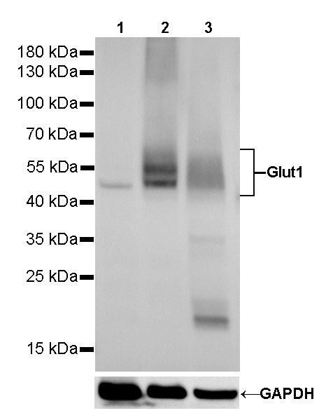 GLUT1 Recombinant Rabbit mAb (SDT-R057)