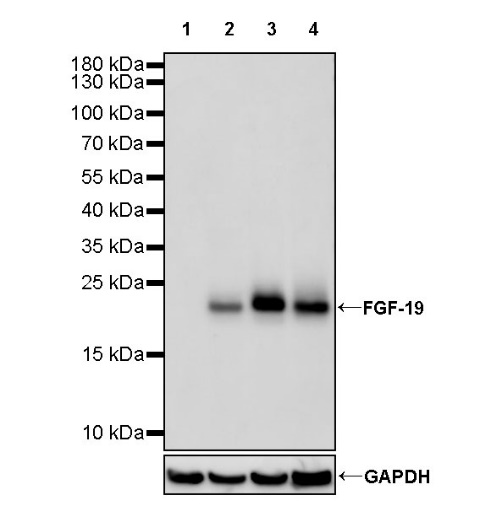 FGF-19 Recombinant Rabbit mAb (SDT-1070-17)