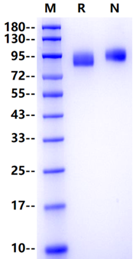 Influenza B HA (B/Florida/4/2006) His Tag Protein