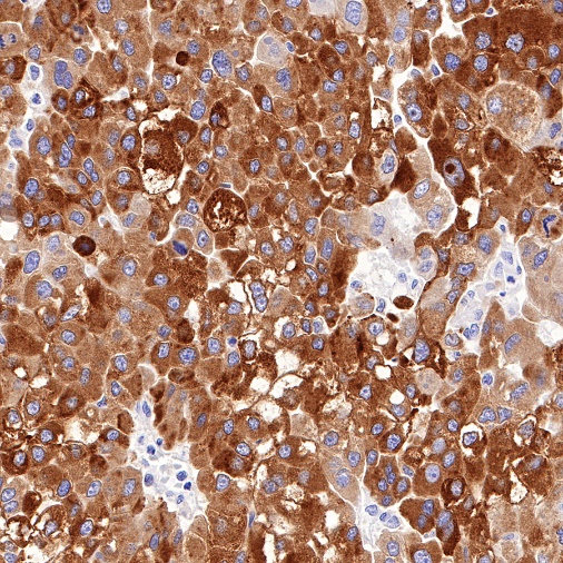 RBP4 Recombinant Rabbit mAb (S-693-111)