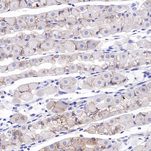 ROR1 Recombinant Rabbit mAb (SDT-R502-2)