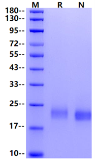 Frizzled-10/FZD10 His Tag Protein, Human