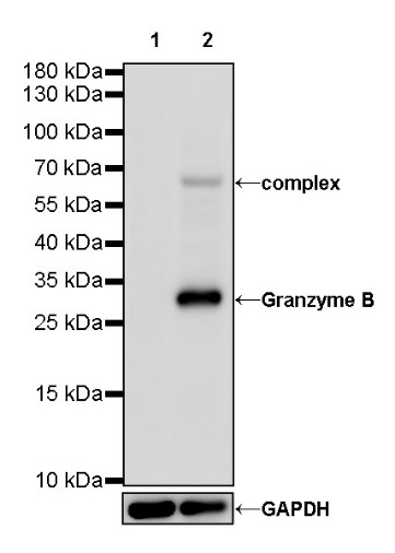 Granzyme B Recombinant Rabbit mAb (S-357-54)