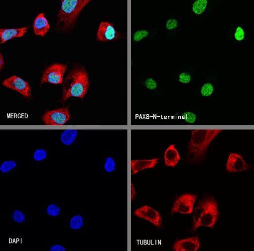 S-RMab® PAX8 Recombinant Rabbit mAb (SDT-R509)