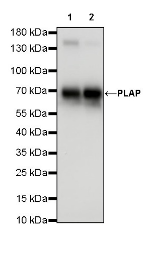 PLAP+ALPI Recombinant Rabbit mAb (SDT-167-155)