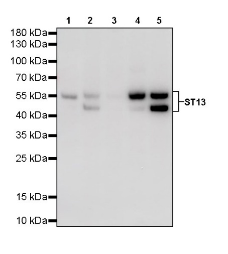 ST13 Recombinant Rabbit mAb (S-661-38)