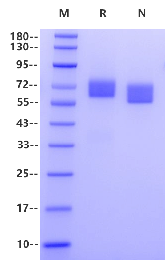 Axl His Tag Protein, Human