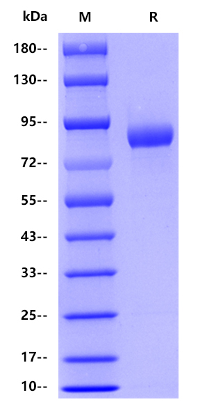 Human CD105, His tag