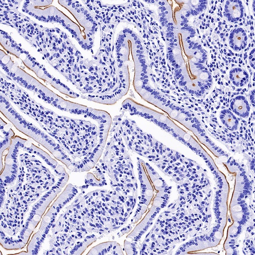 MUC17 Recombinant Rabbit mAb (SDT-1415-49)