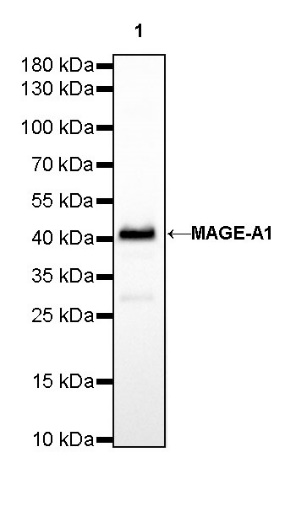 MAGE-A1 Recombinant Rabbit mAb (S-R183)